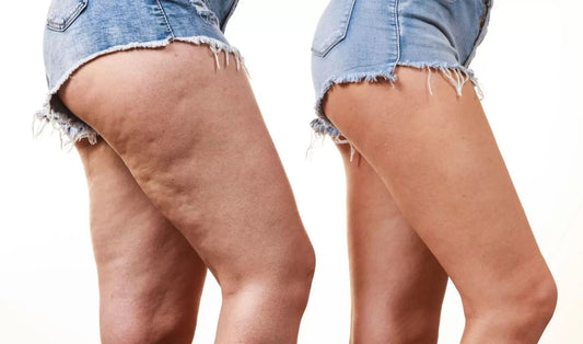 Drainage lymphatique & Endosphères Therapie : pourquoi ces soins transforment la silhouette plus qu’on ne l’imagine